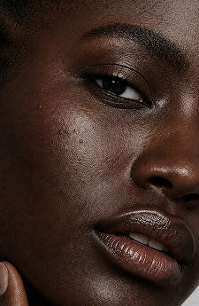 Dark Skin